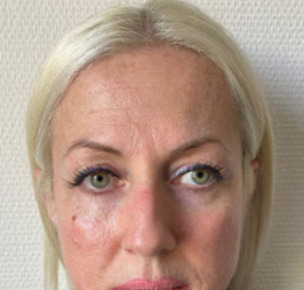 Előtte